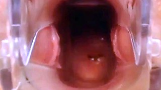 Webcam Pussy Play with Speculum