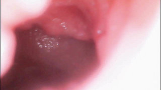 Endoscope Creampie. Cam Inside Pussy Shows Dick Cumming Inside Pussy