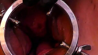 Speculum & Microcamera for Lady Soniac