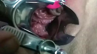 Massive squirt on camera lens after speculum and double penetration