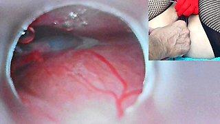 Japanese Mom Insemination Cum into Uterus and Endoscope Cam